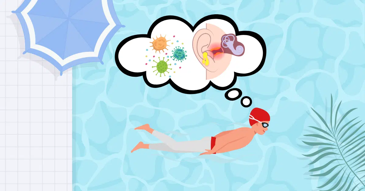 Plavalčevo uho: vzroki, simptomi, zdravljenje in preventiva